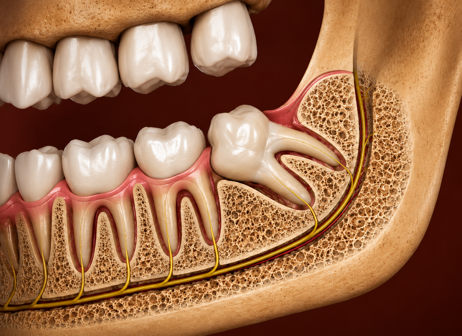 Wisdom Molar Extraction