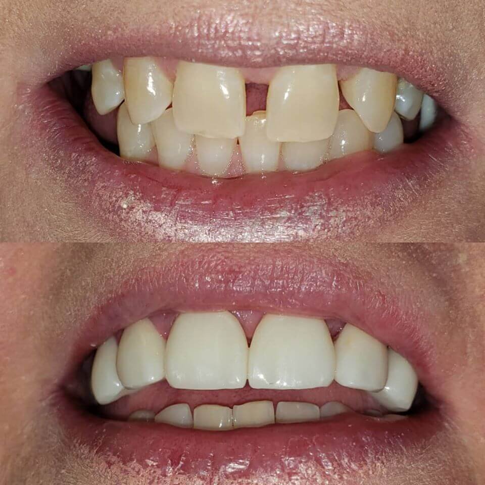 Treatment Work 1
