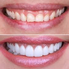 Treatment Work 10