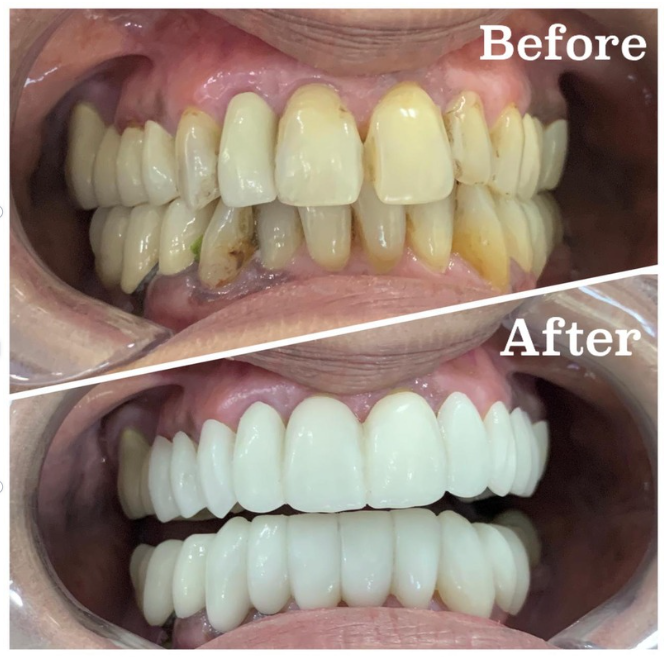 Treatment Work 2
