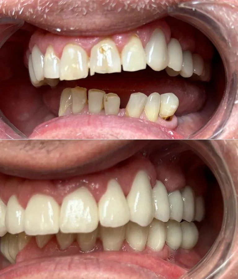 Treatment Work 3