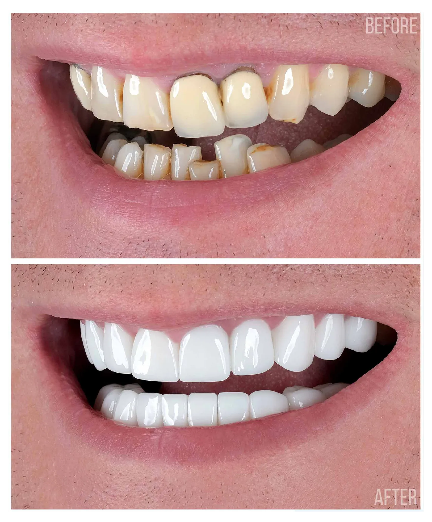 Treatment Work 4