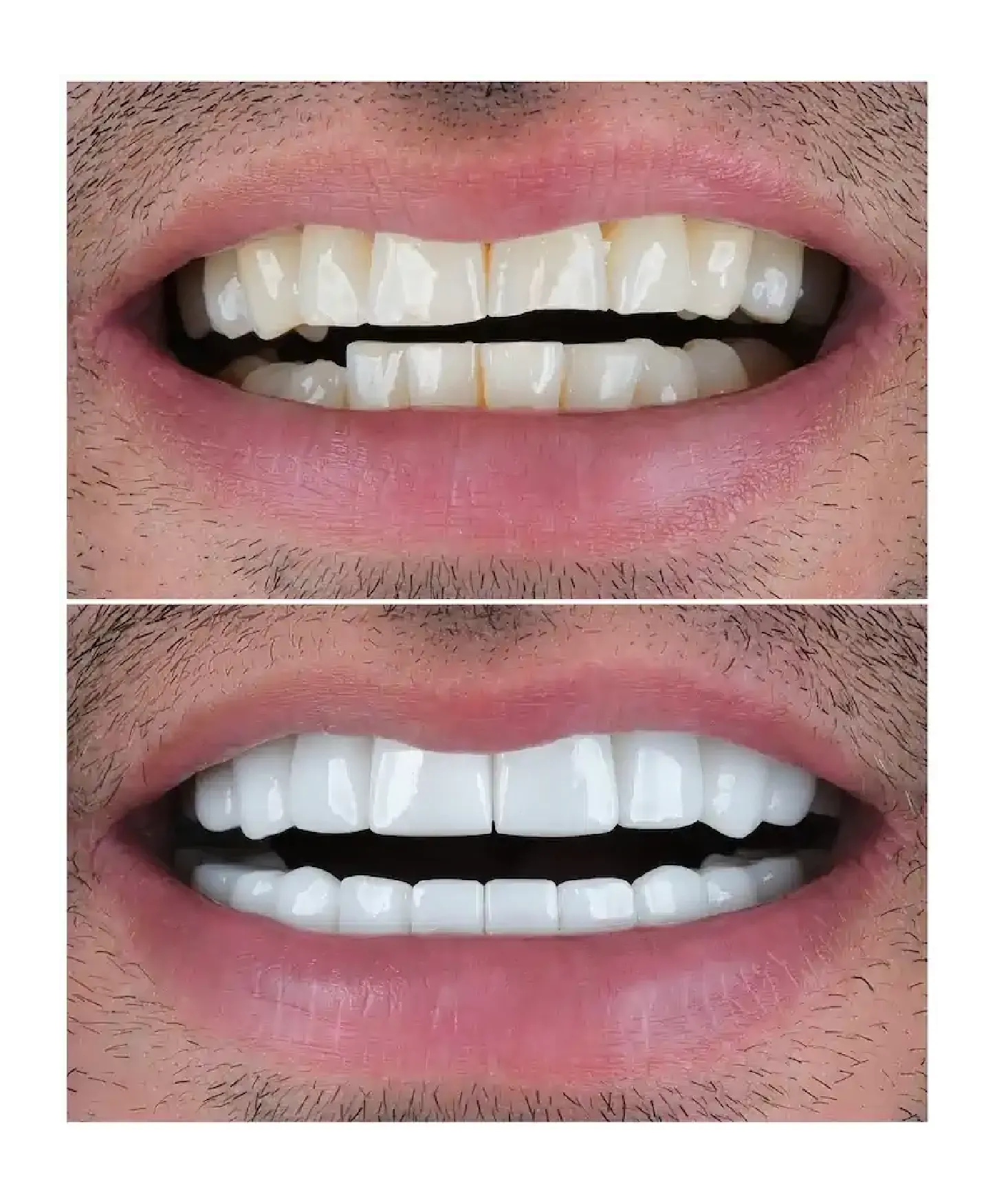 Treatment Work 5