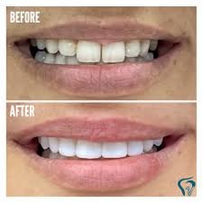Treatment Work 6
