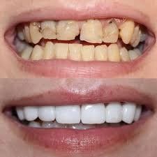 Treatment Work 7