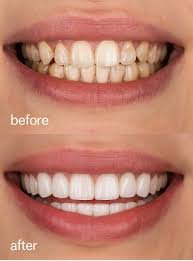 Treatment Work 8