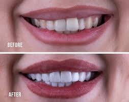 Treatment Work 9
